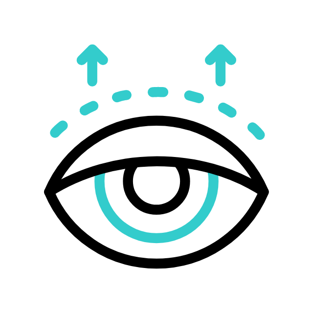 gif levantamiento de párpado estética ocular