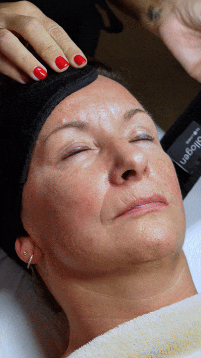 soins du visage anti-age bruxelles chez medi kiss dermaclinic