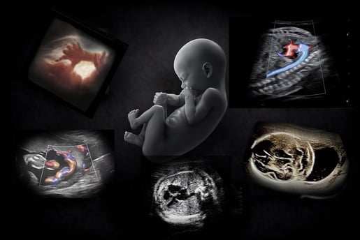 Image of a fetus surrounded by ultrasound images of obstetric ultrasound.