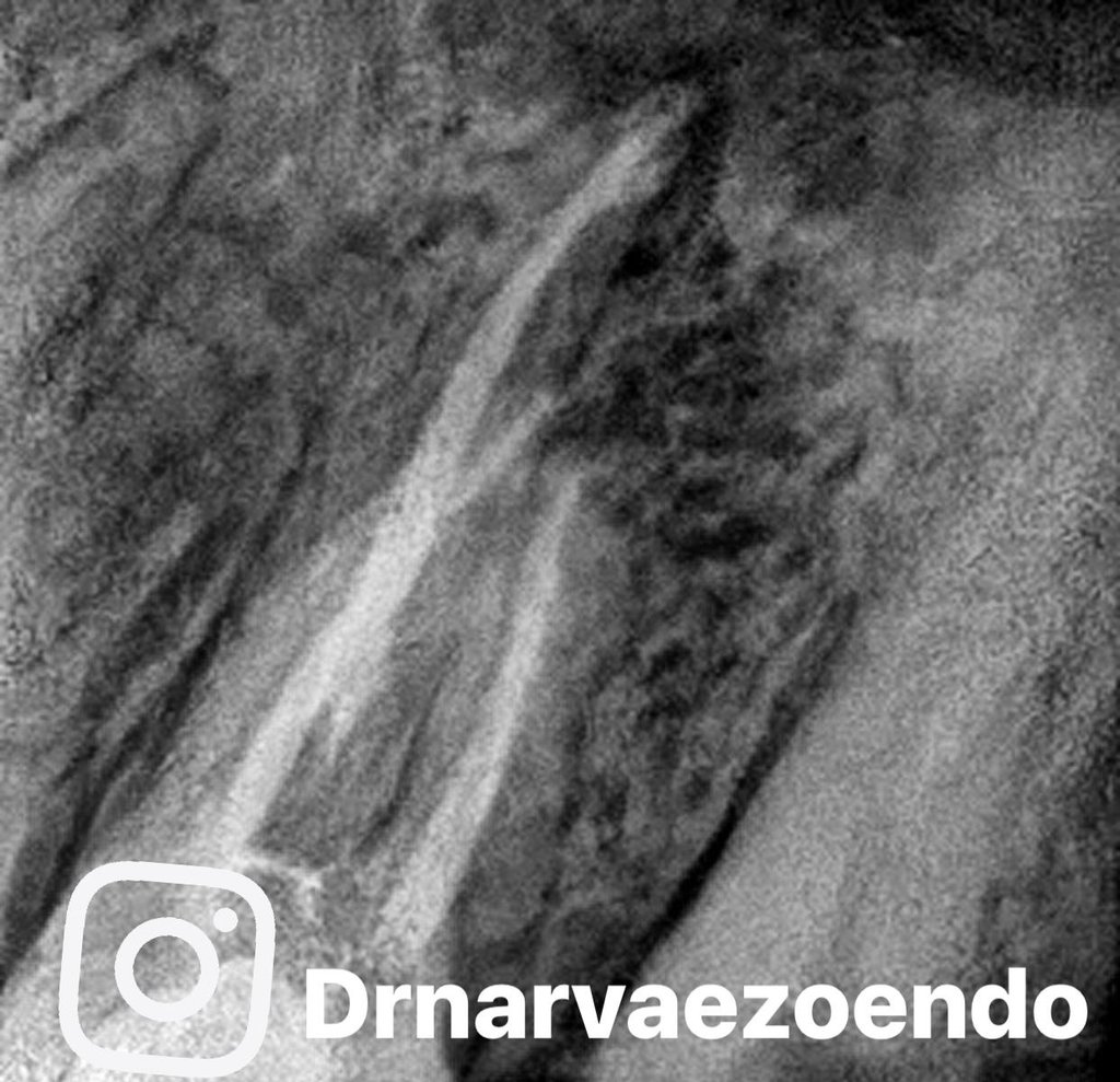 Endodoncia Quito, Dr. Juan Miguel narváez