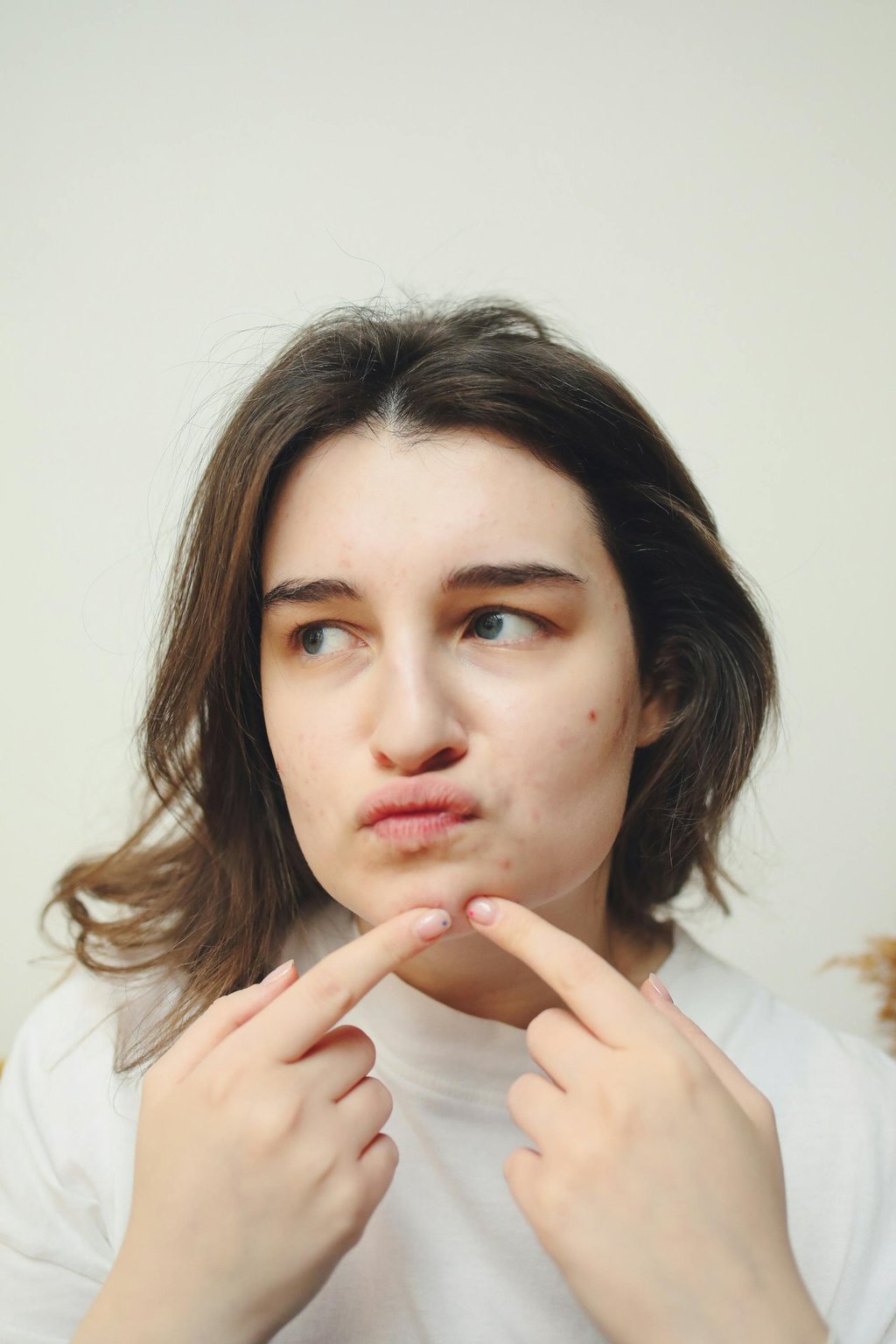 Young woman inspecting her skin and pointing to acne breakouts on her chin for a skincare routine.