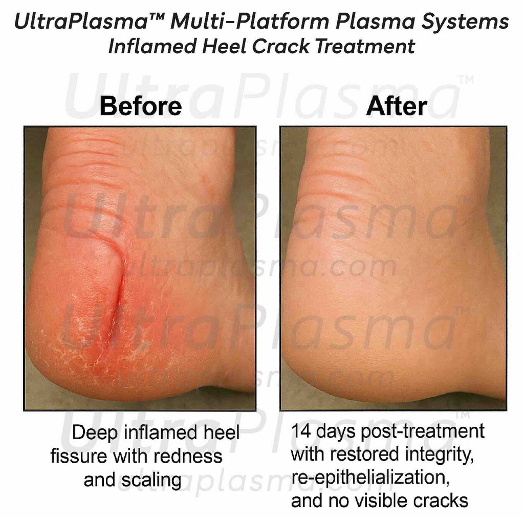 ultra_plasma_ultra_plazma_ultra-plasma_ultra-plazma