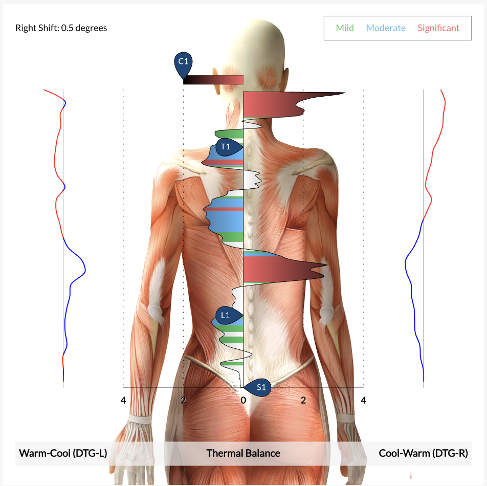 Neurological scans help show Dr. Spencer how and where their nervous system is stressed