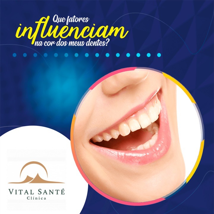 Dentista recreio, clareamento dental recreio