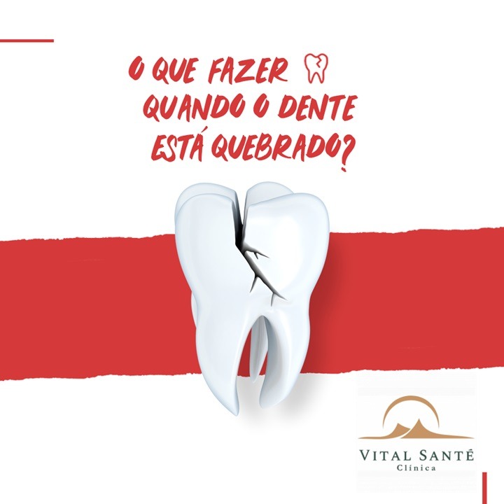 dente quebrado dentista recreio