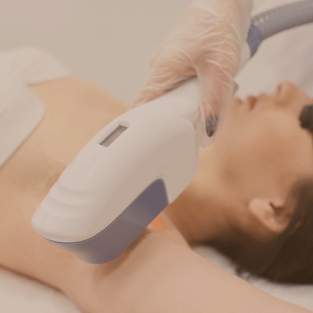 Depilación láser en axilas, cuello y bikini clásico en Narvarte.