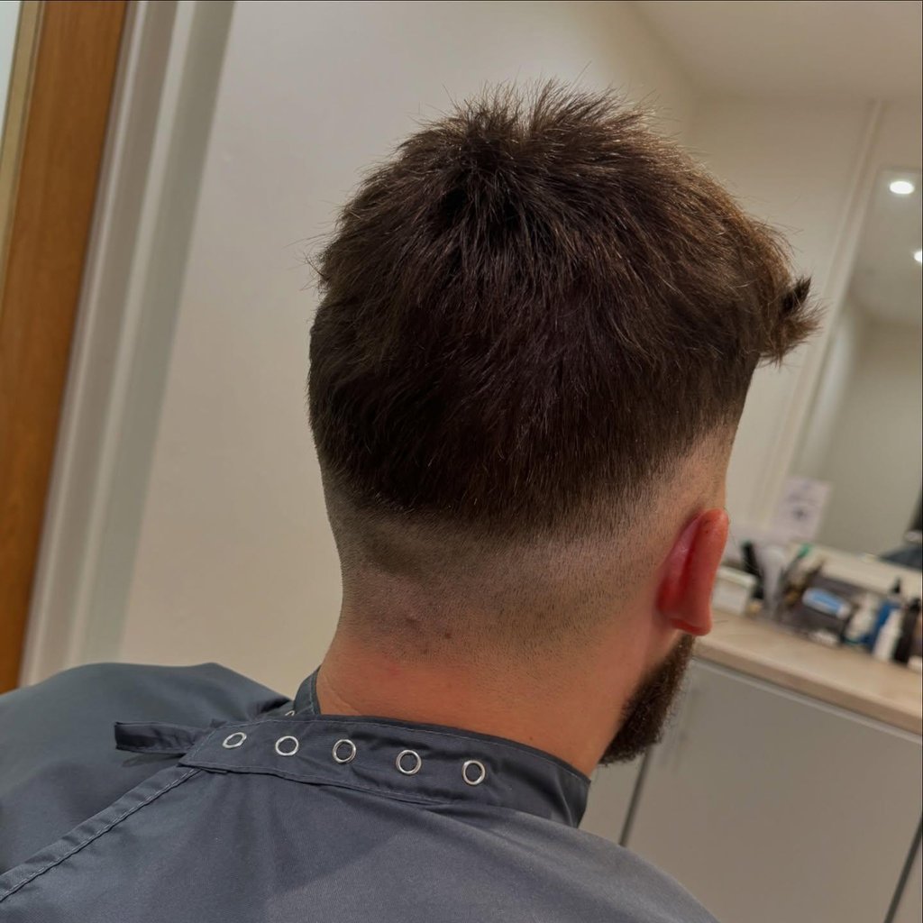 hair loss treatments in hull