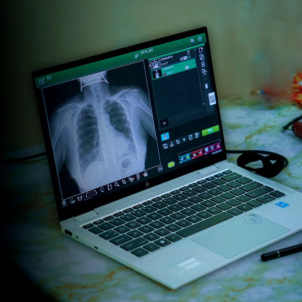 Tampilan hasil rontgen dada pada layar laptop di ruang pemeriksaan medis