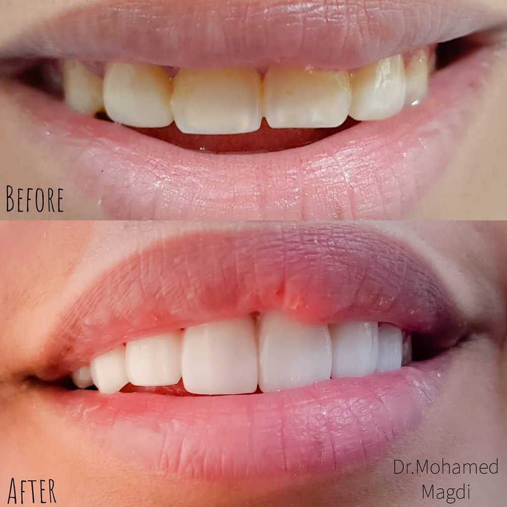 تنظيف جير في الكويت