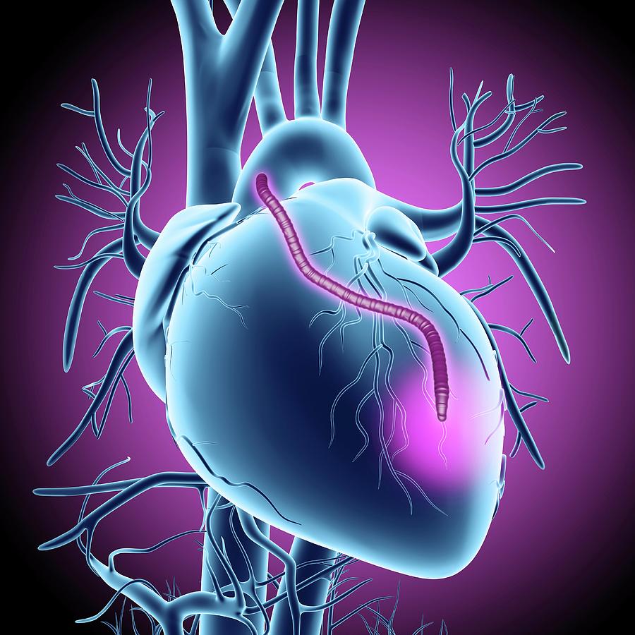 vascular ultrasound coronary artery bypass graft mapping radial surgery heart arm scan imaging perth blocked cabg chest pain