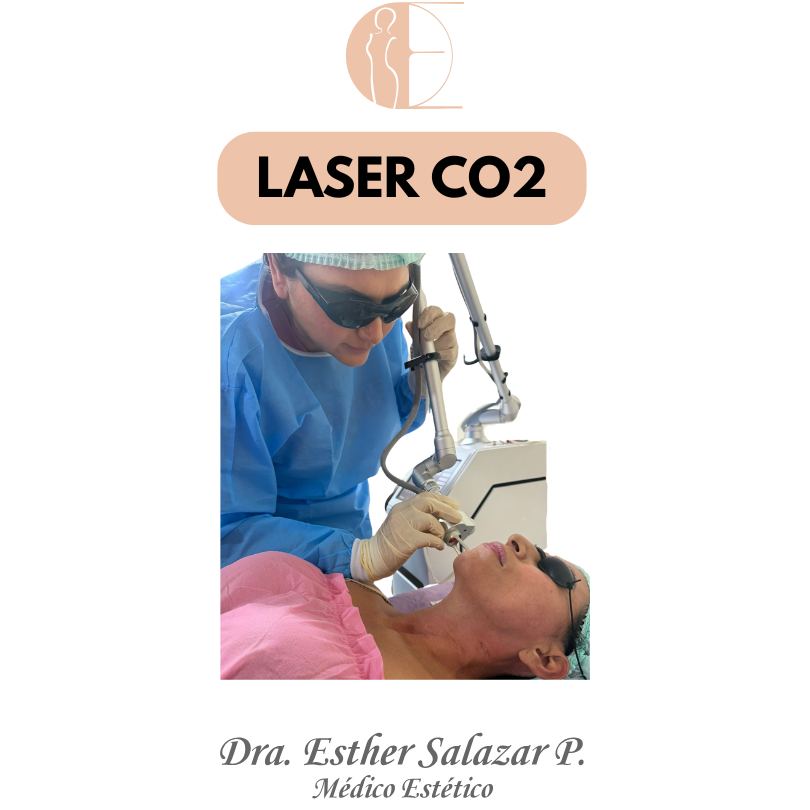 LASER CO2 GUAYAQUIL