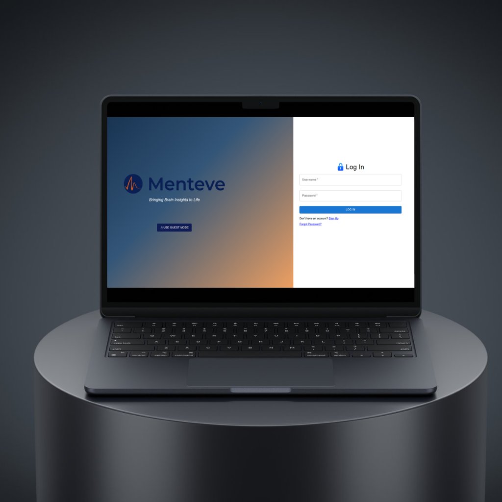 a laptop computer sitting on a table with a monitor screen