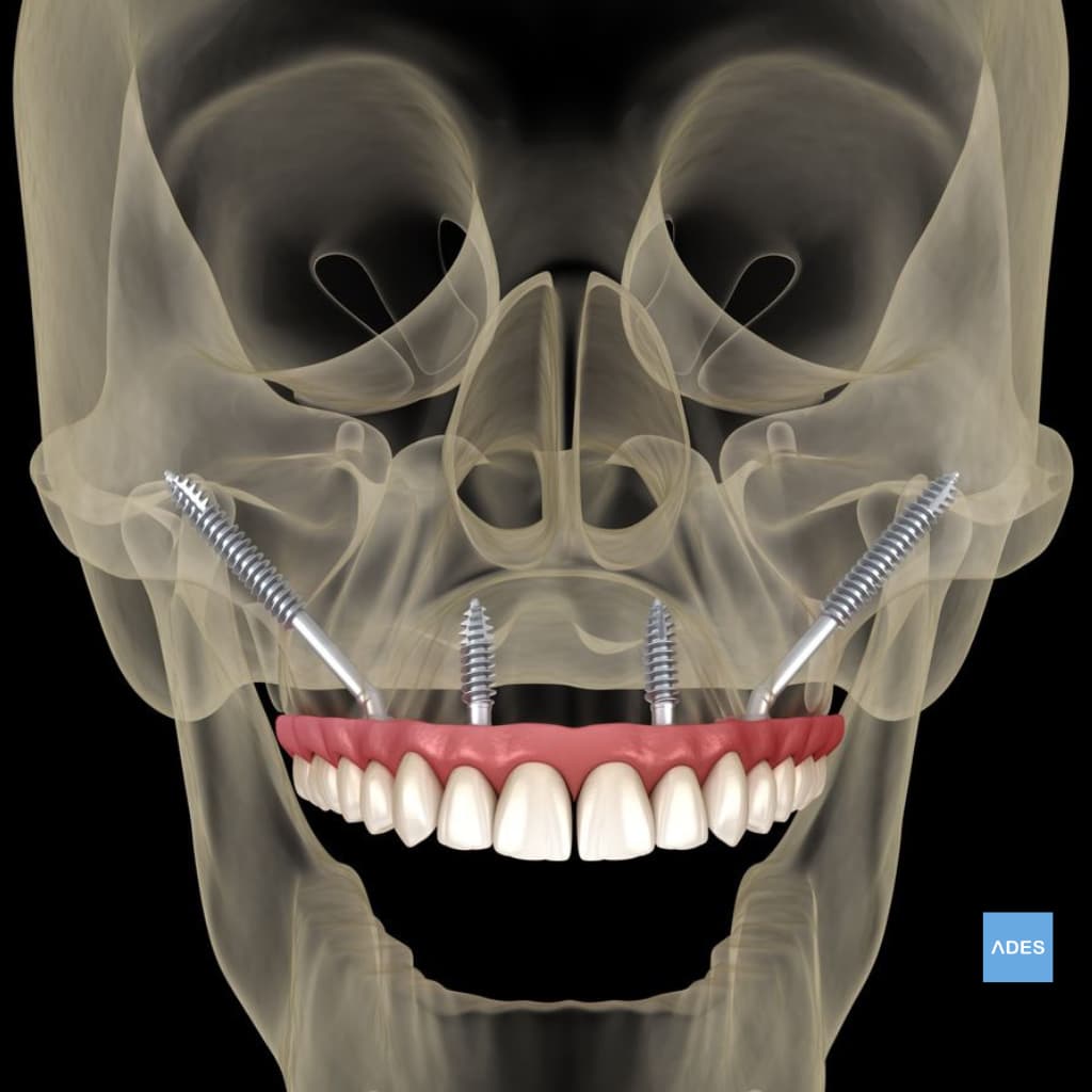 Diagnóstico dental en Clínica ADES Badajoz