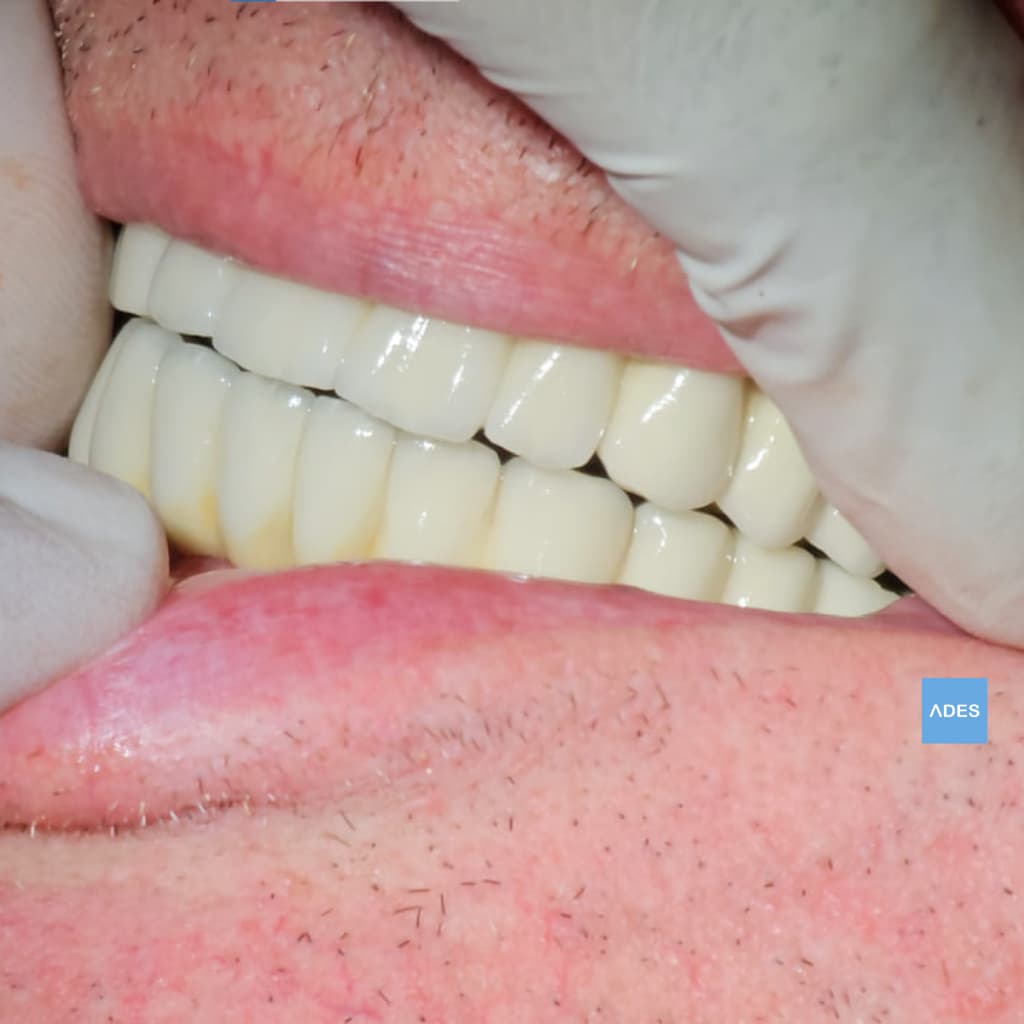 Dentista revisando dientes en Badajoz