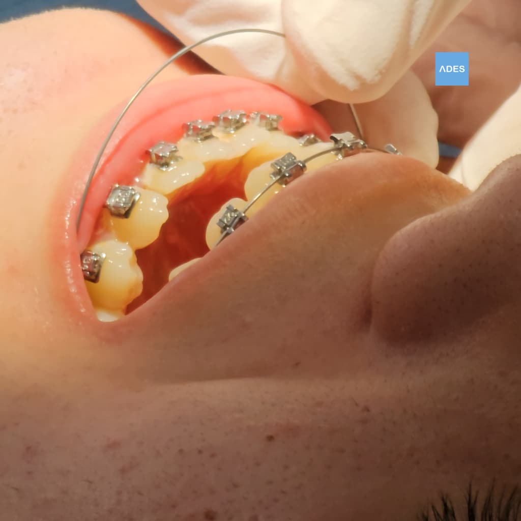 Revisión bucal en Badajoz