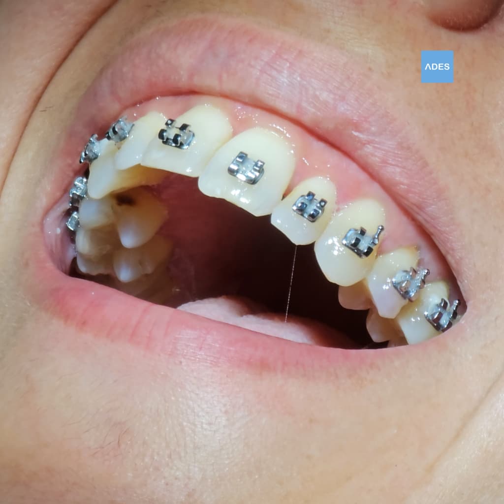 Niños en odontopediatría en Badajoz