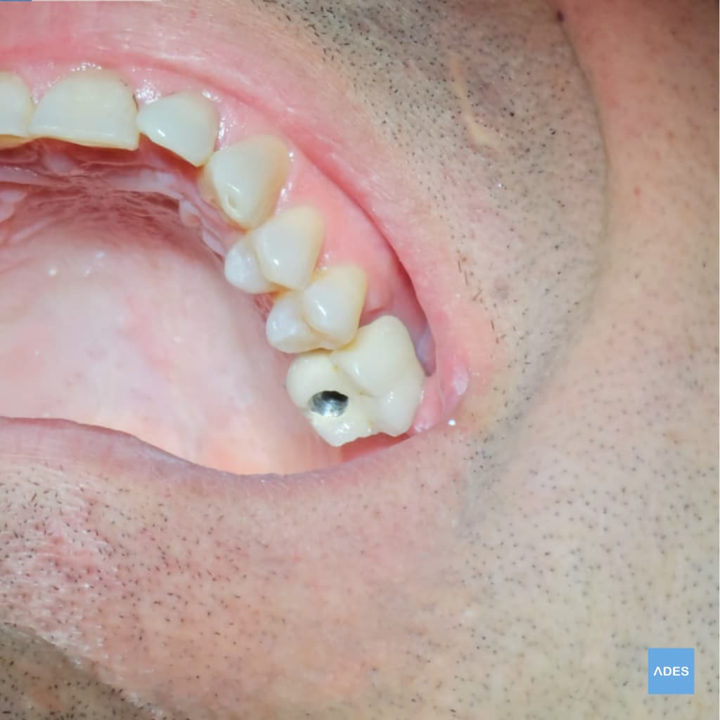 Paciente recibiendo atención odontológica en Badajoz