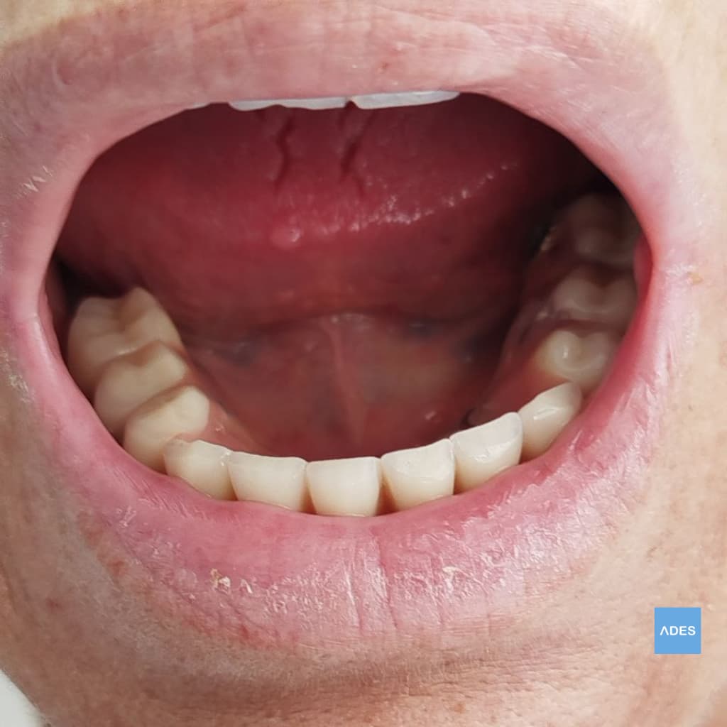 Paciente feliz con sonrisa blanca en Badajoz