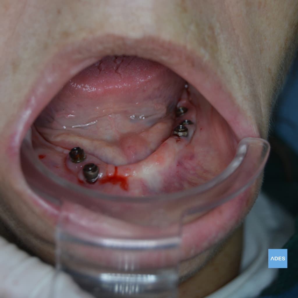 Clínica dental en Calle Castillo de Zafra, Badajoz