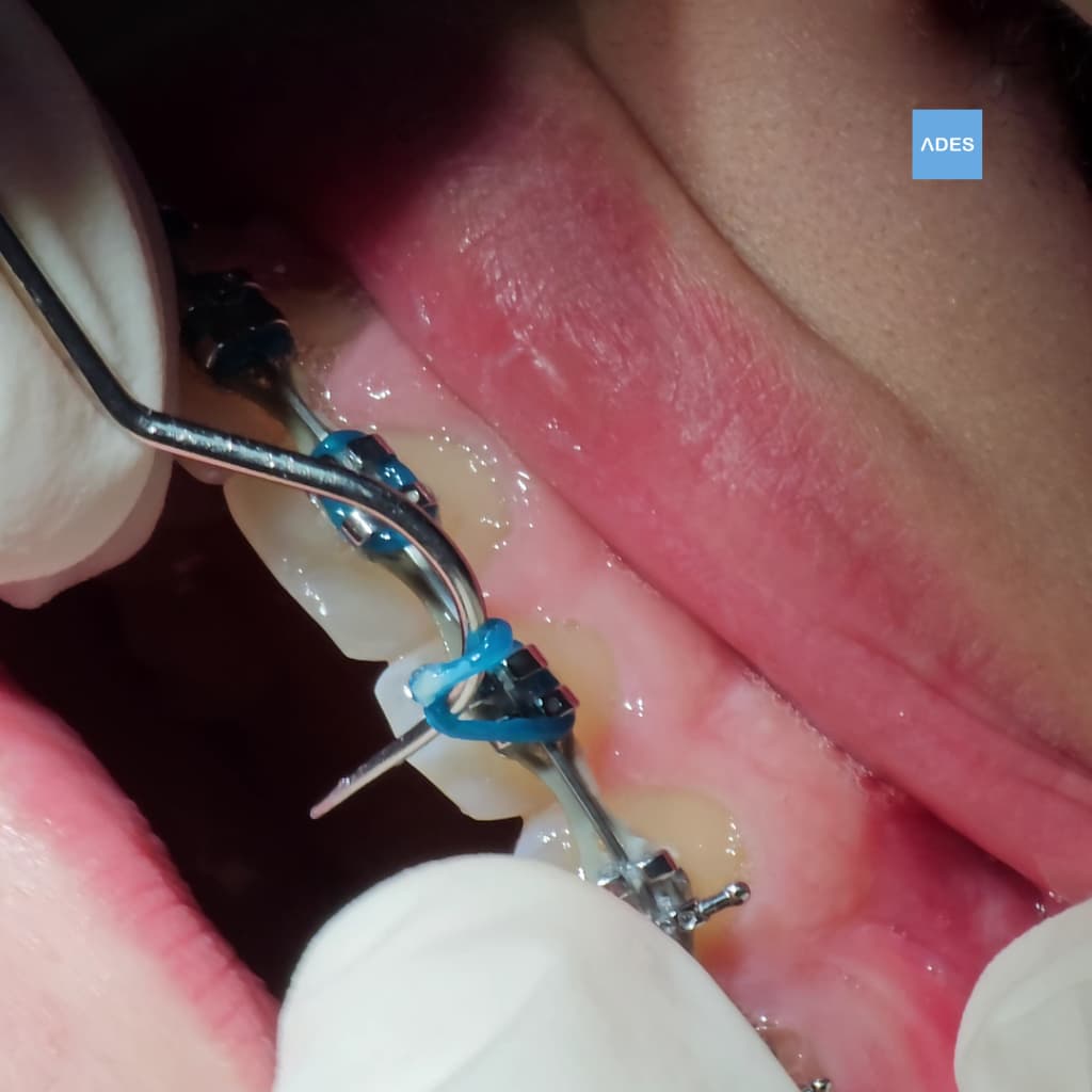 revision ortodoncia clinica dental ades