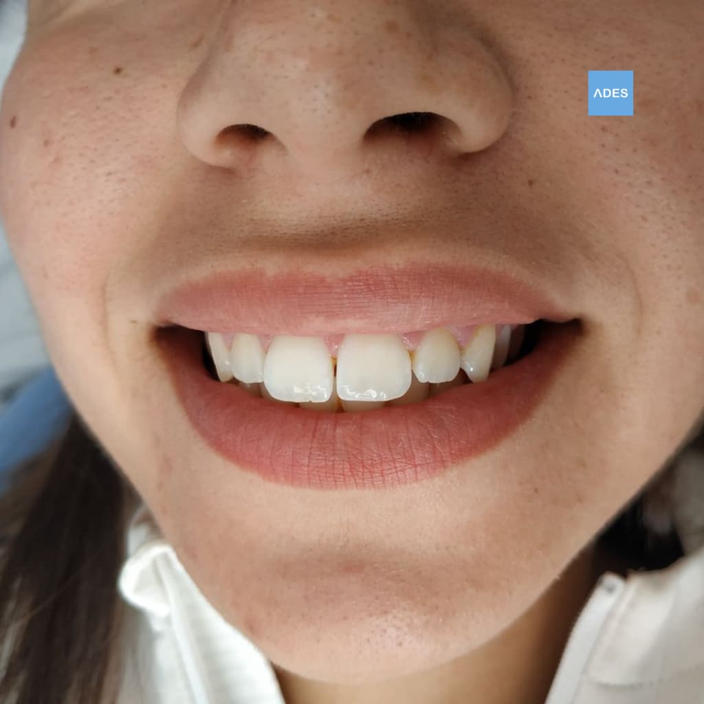 Ortodoncia infantil clinica dental ades