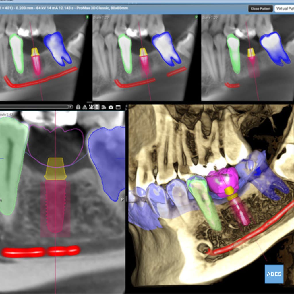 Clínica dental con tecnología avanzada en Badajoz