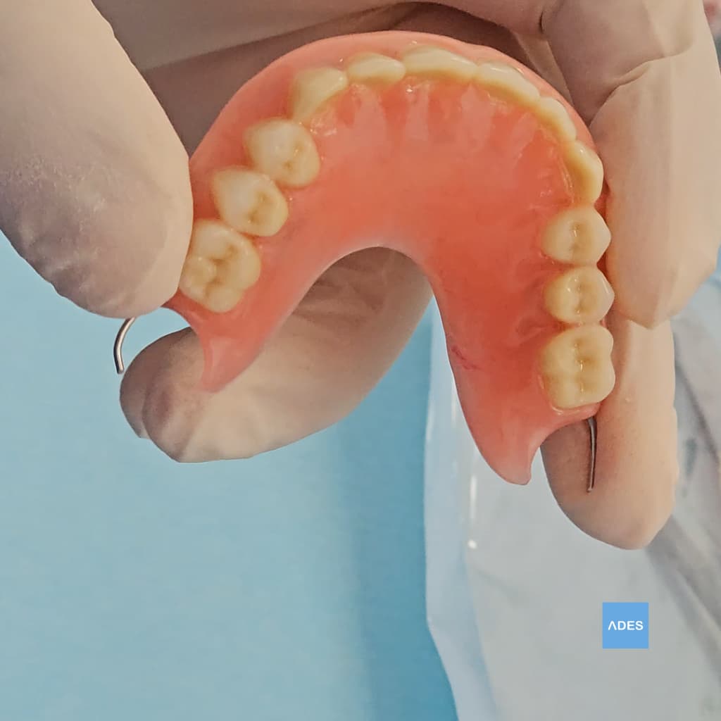 protesis removible