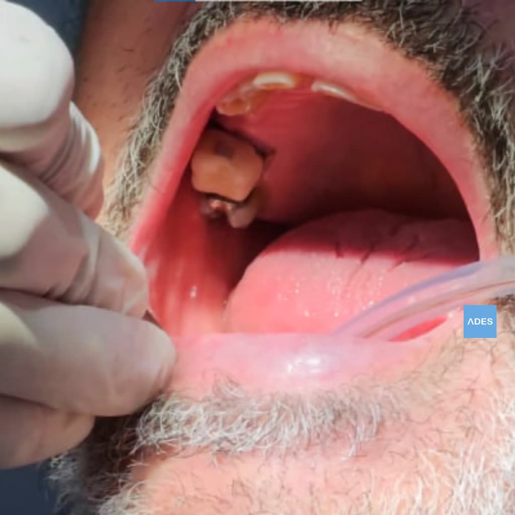 Diagnóstico odontológico en Badajoz