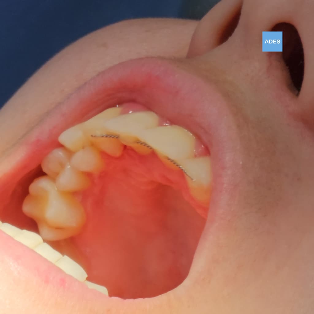 Paciente en silla de ortodoncia en Badajoz