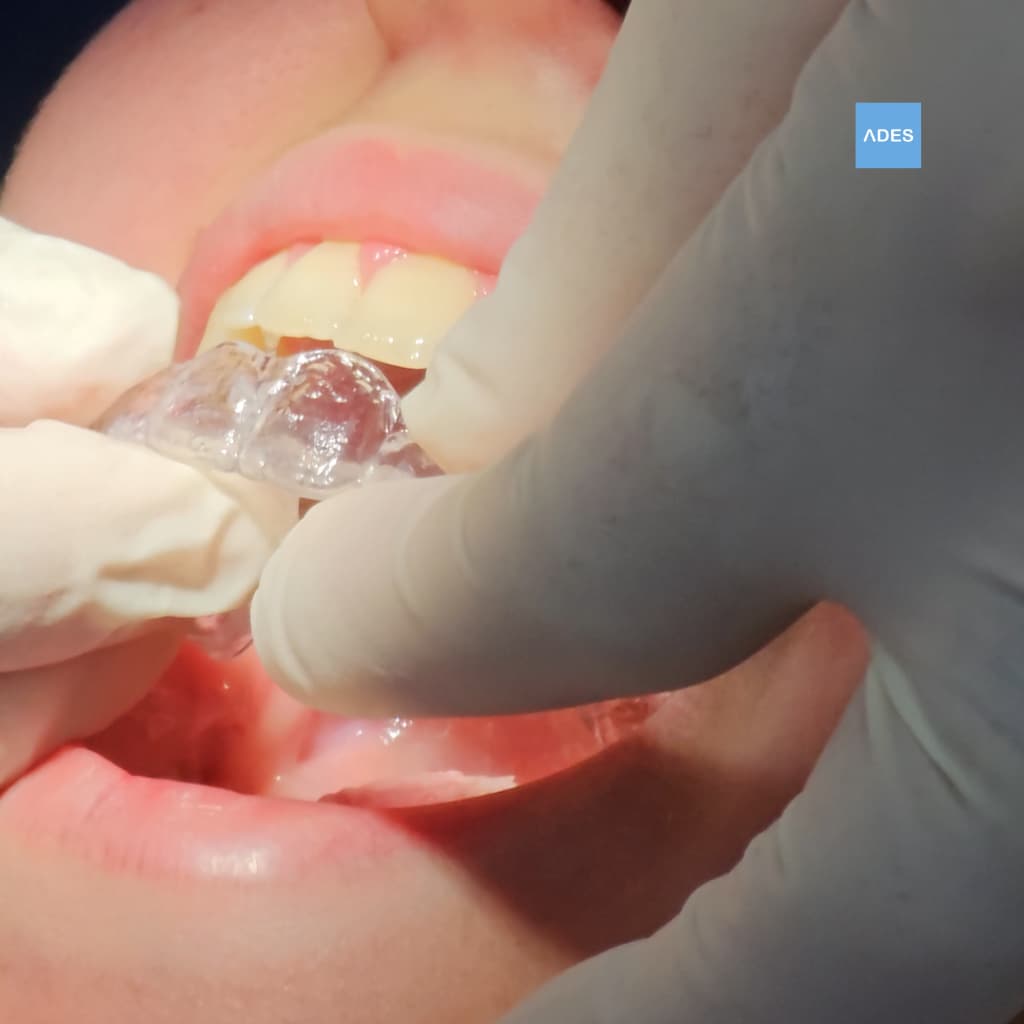 Ortodoncia Invisible Badajoz