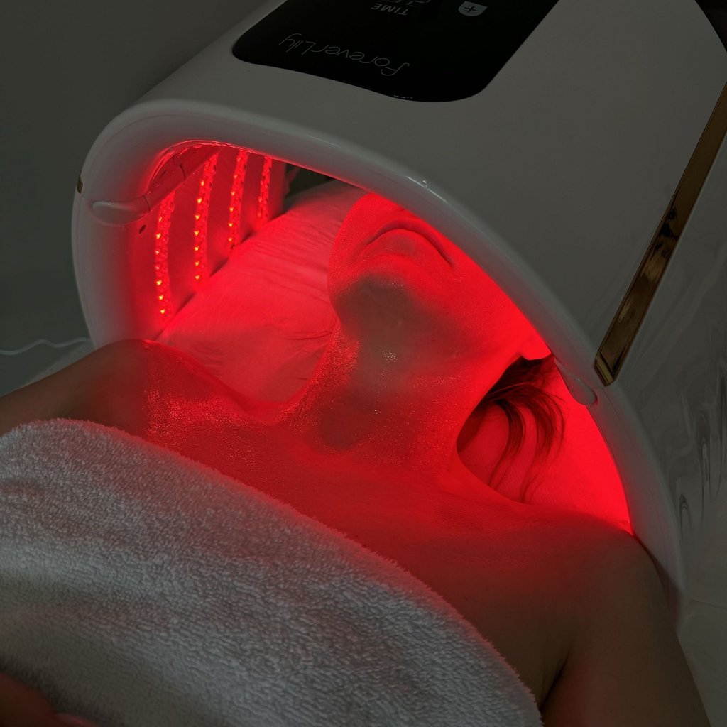 Oxygen Carboxy Therapy – Karboksyterapia