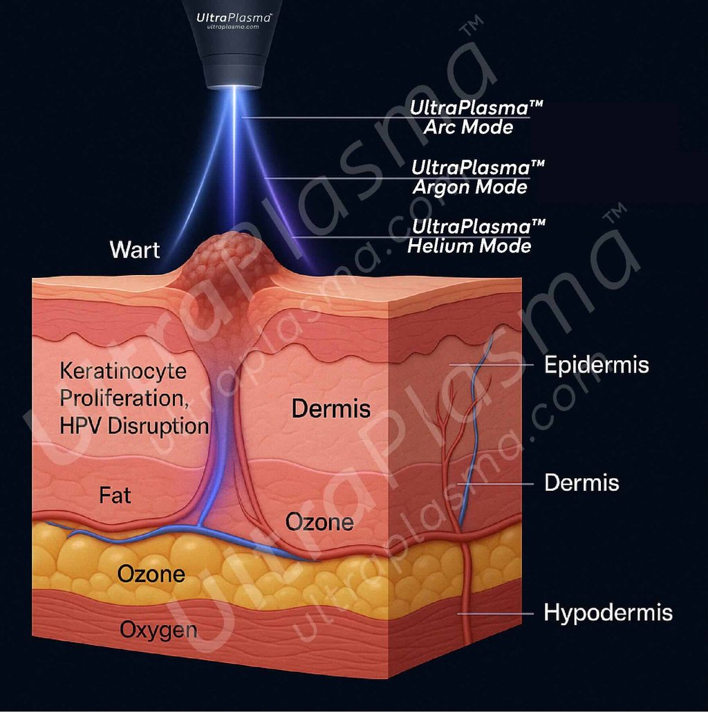 ultra_plasma_ultra_plazma_ultra-plasma_ultra-plazma