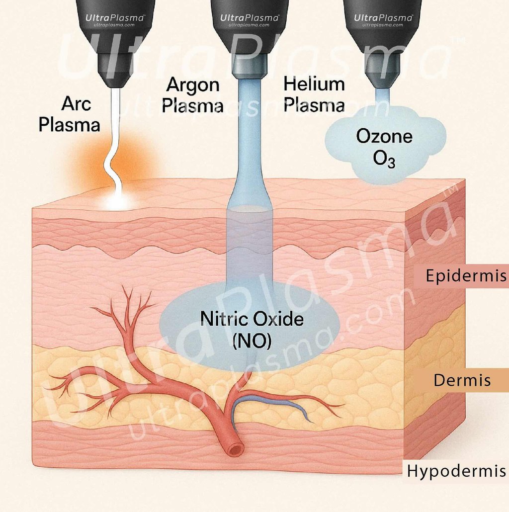 _ultra_plasma_ultra_plazma_ultra-plasma_ultra-plazma