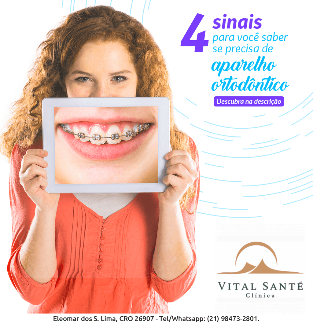 Aparelho dentário