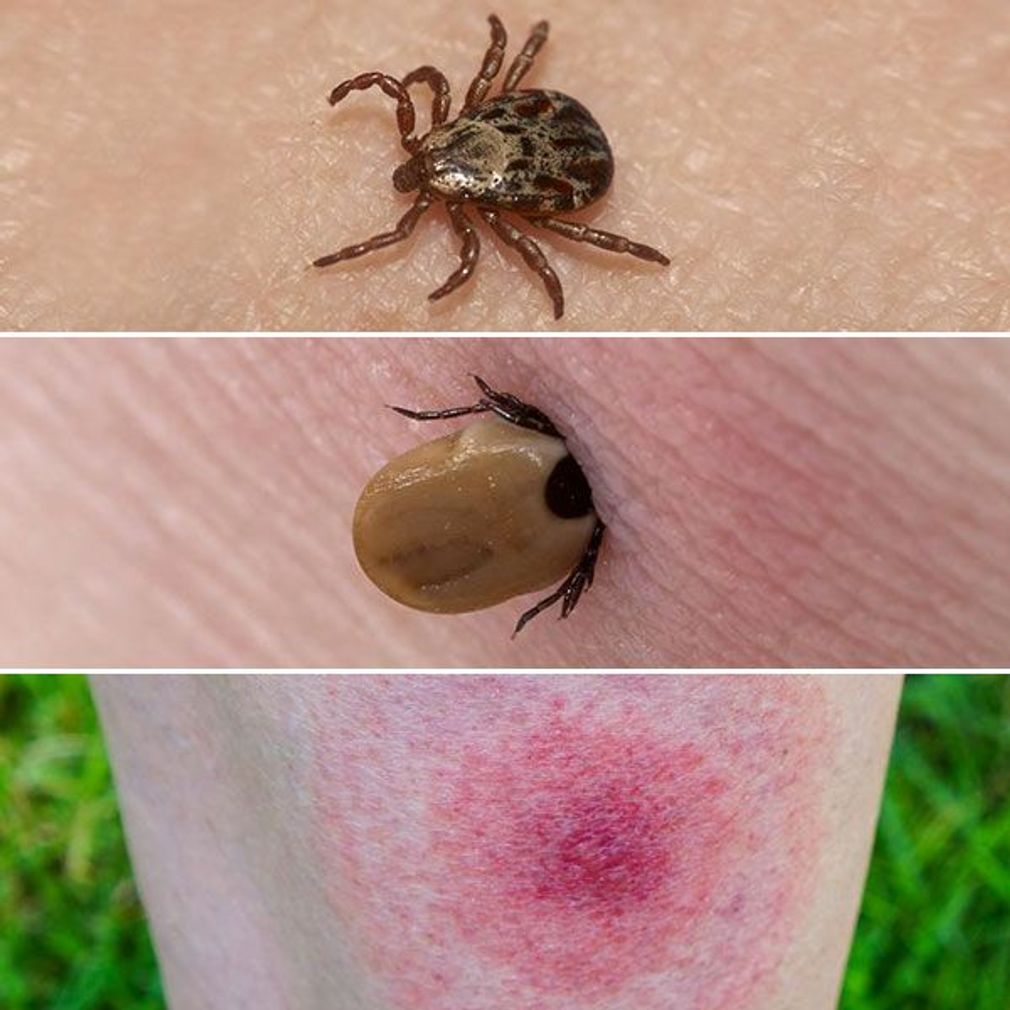 tiques, encéphalite estivale, Lyme, Dr Cédric Yves Bandelier, médecin généraliste , La Tour-de-Peilz