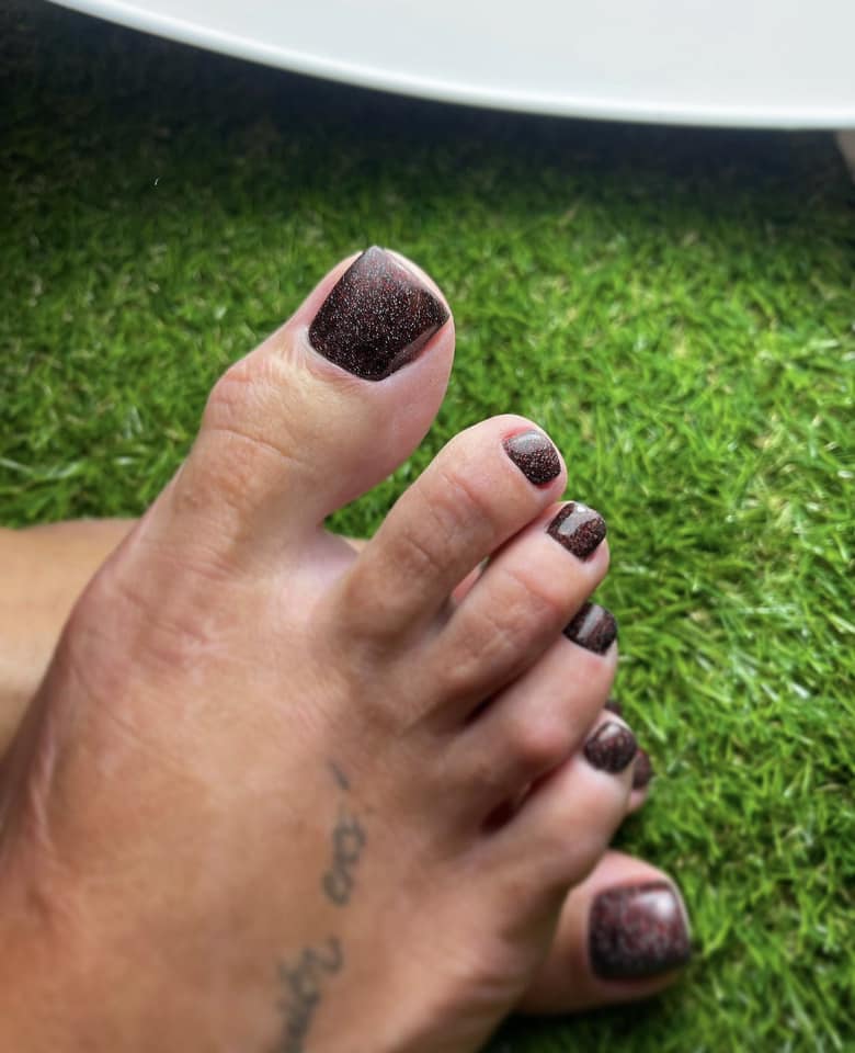 Podologas atliko aparatinį pedikiūrą ir pašalino nuospaudas