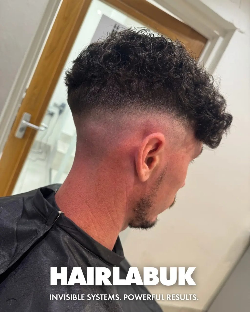 male hair loss sytems in hull 