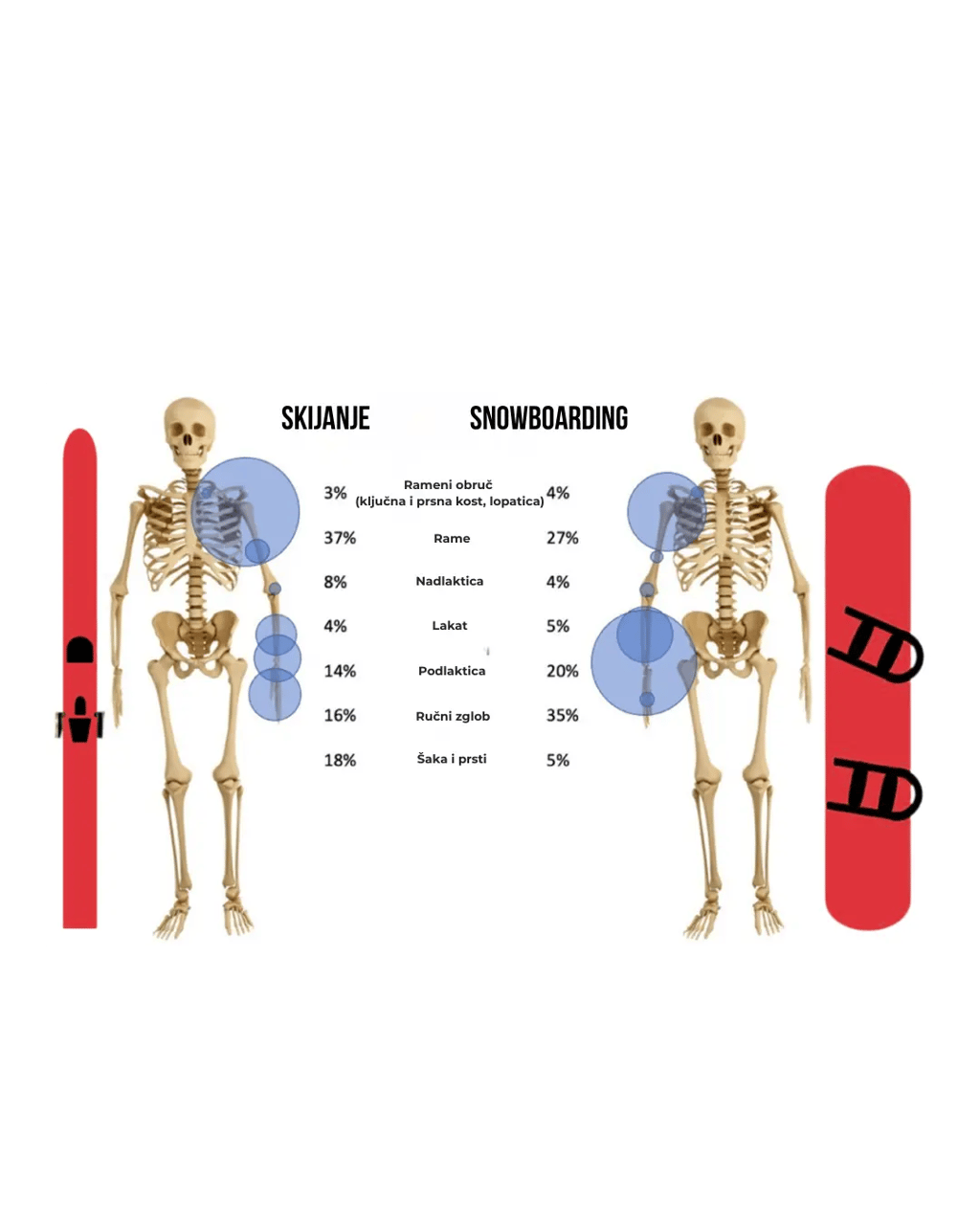 Je li opasnije skijanje ili snowboarding?
