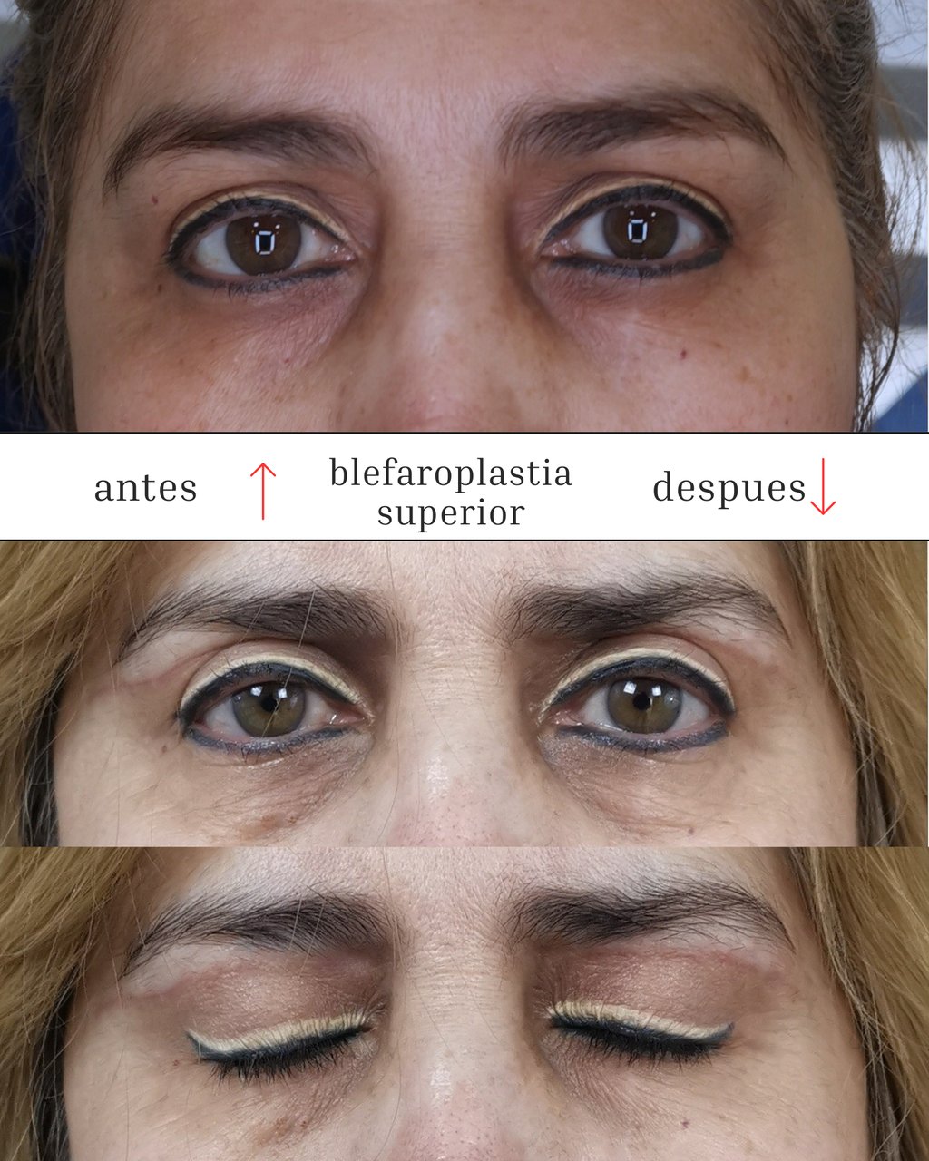 Cirugía Plástica y Rejuvenecimiento Dr. Fabián Orozco