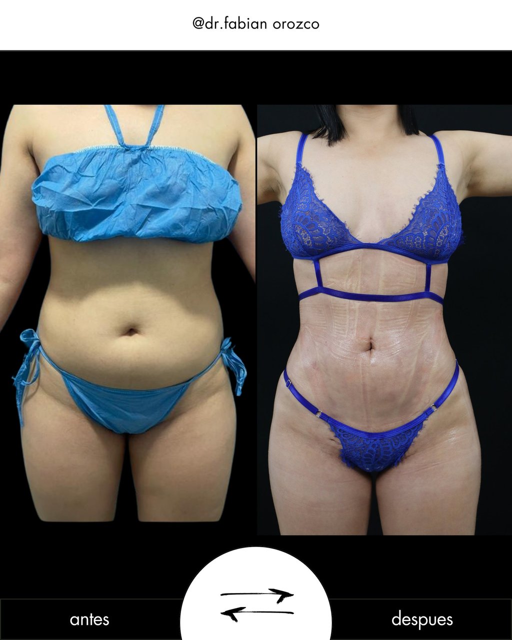 Cirugía Plástica y Rejuvenecimiento Dr. Fabián Orozco