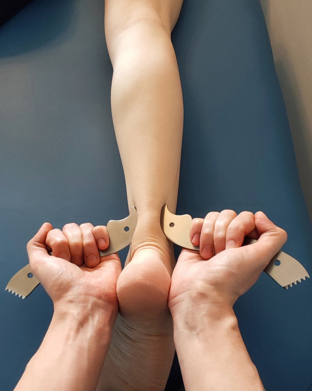 zapalenie Achillesa terapia Kłodzki Fizjo