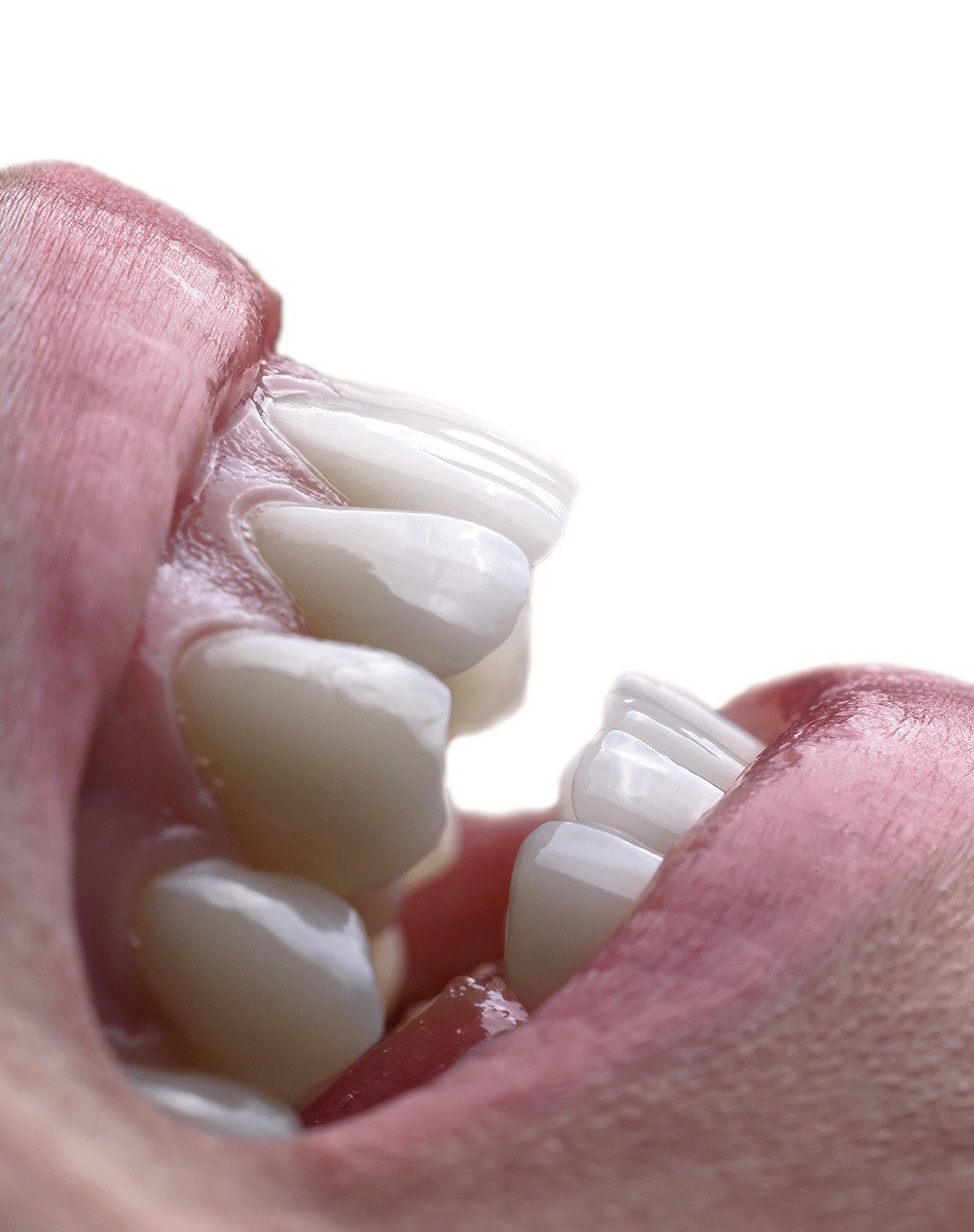 odontologinė fotografija