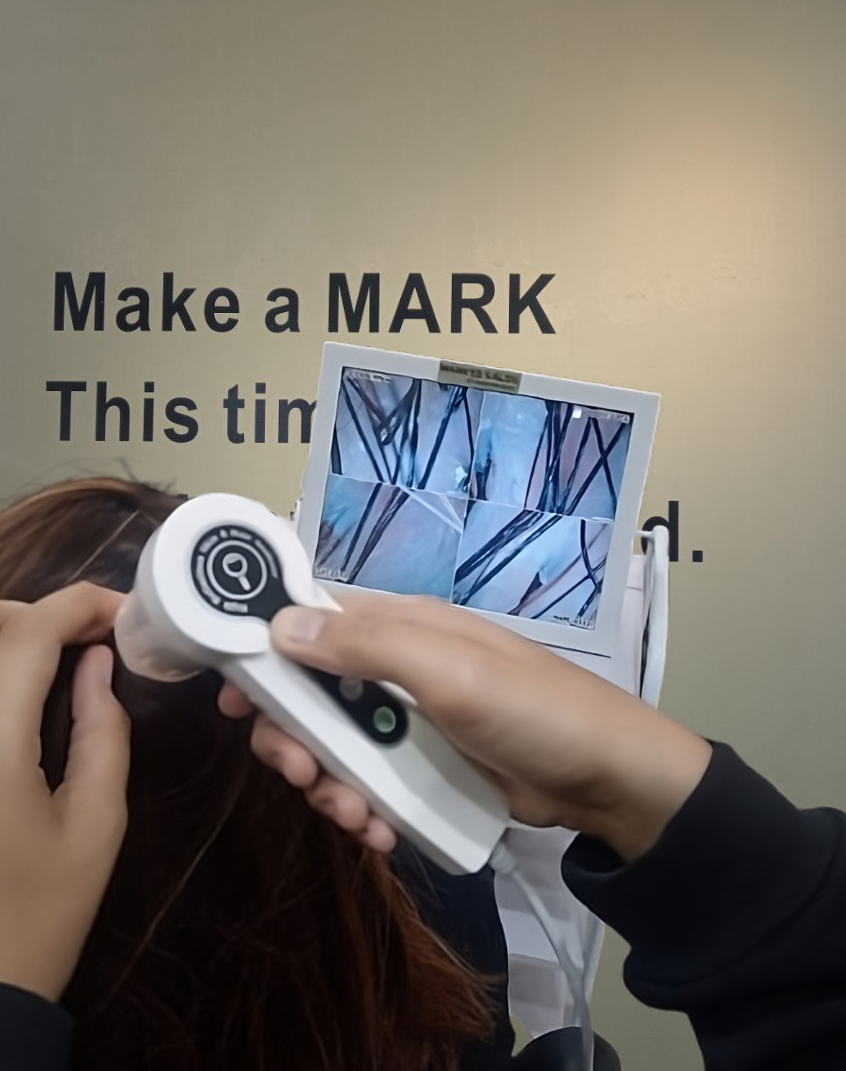 Hair Scalp Analysis