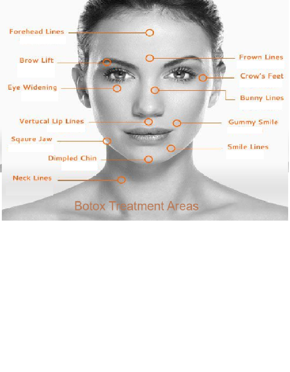 Botox treatment areas for wrinkle reduction at Gurugram (Gurgaon) clinic.