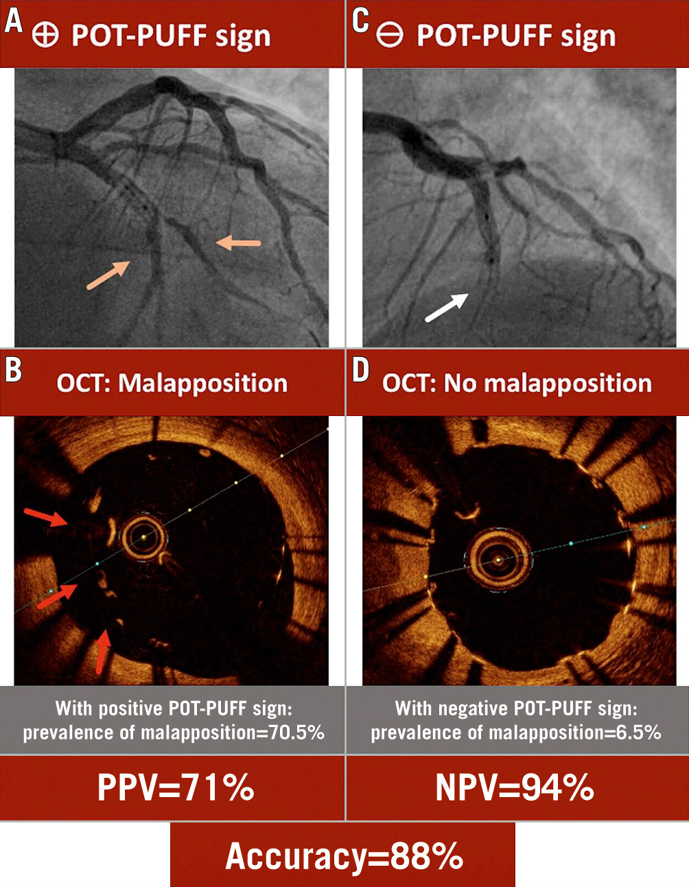 Eurointervention Aminfar et al