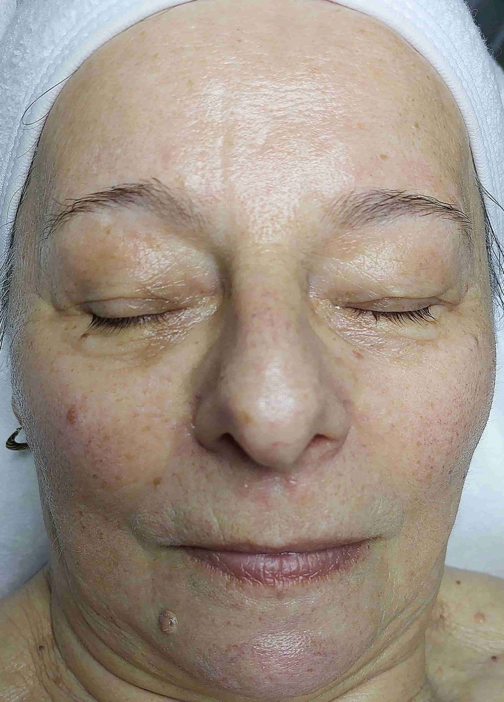 Neuro Cannabis kezelés eredménye veszprém