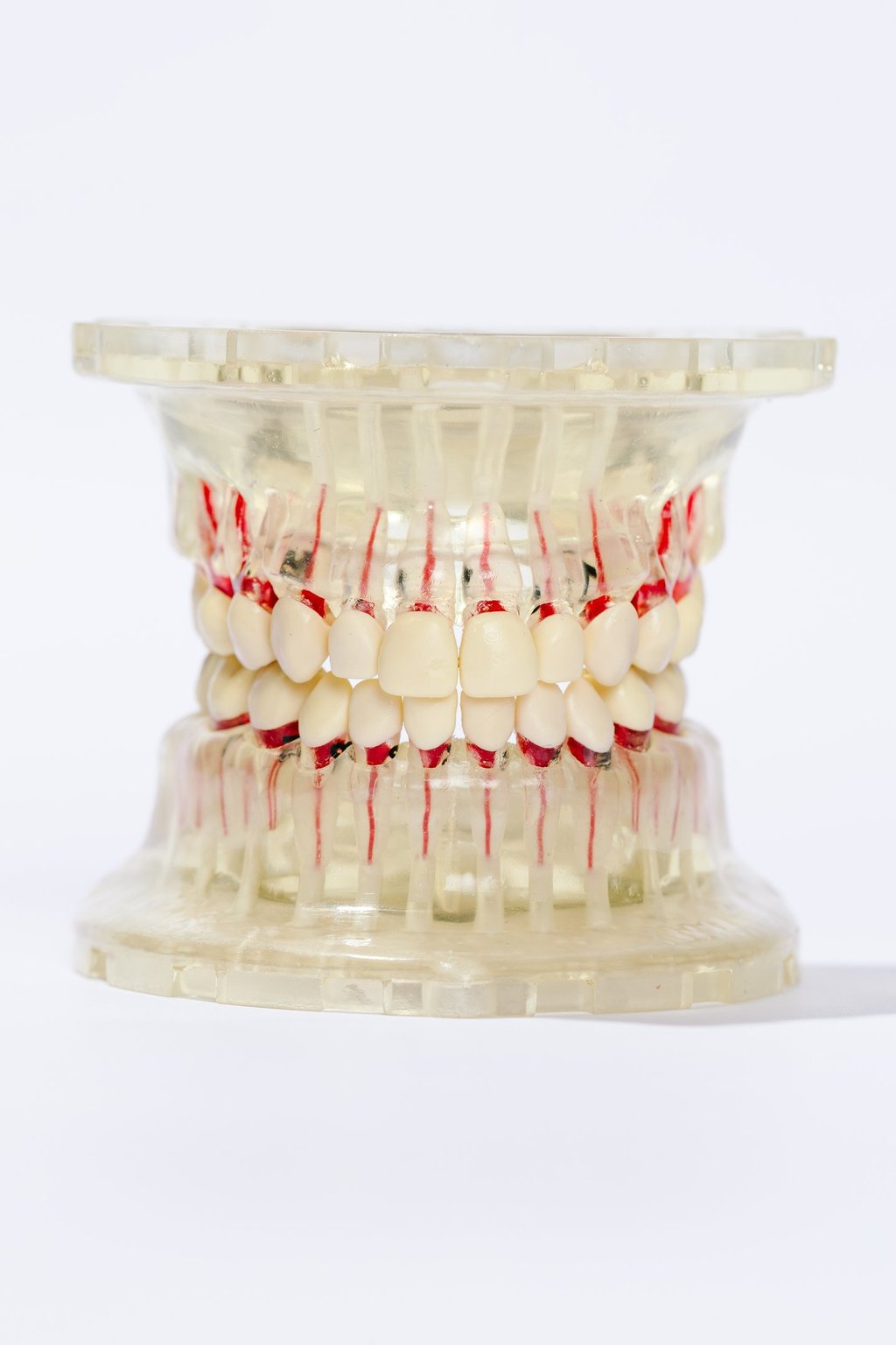 Cámara pulpar y conducto radicular en cada diente.