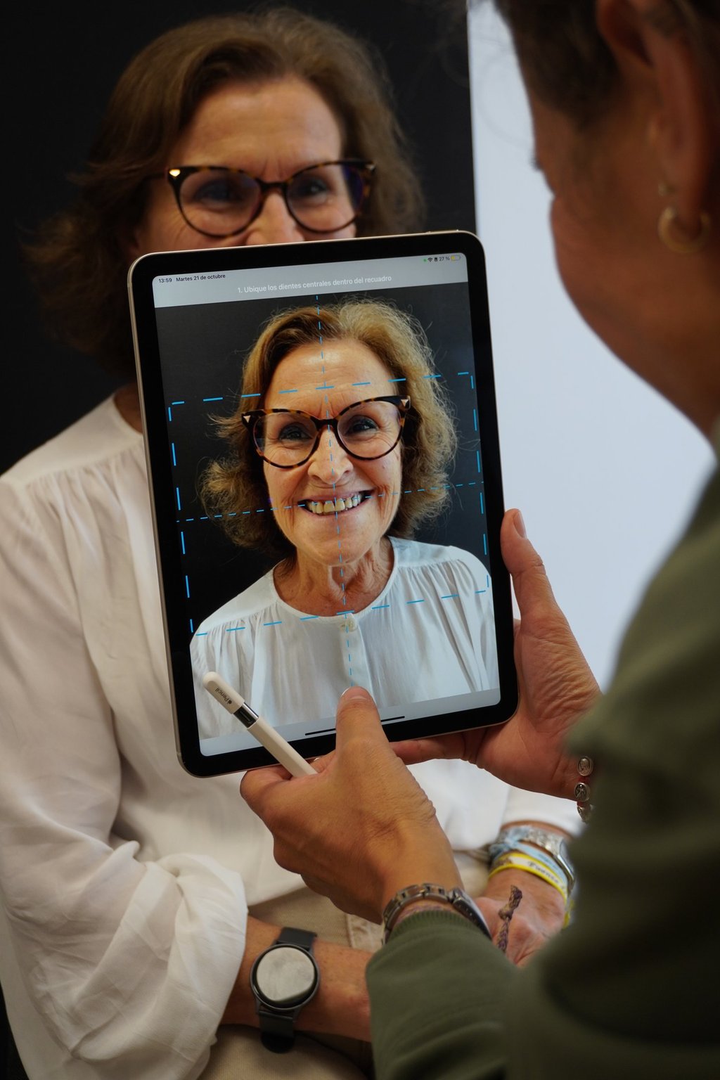 Diseño de sonrisa con Carillas en Sevilla