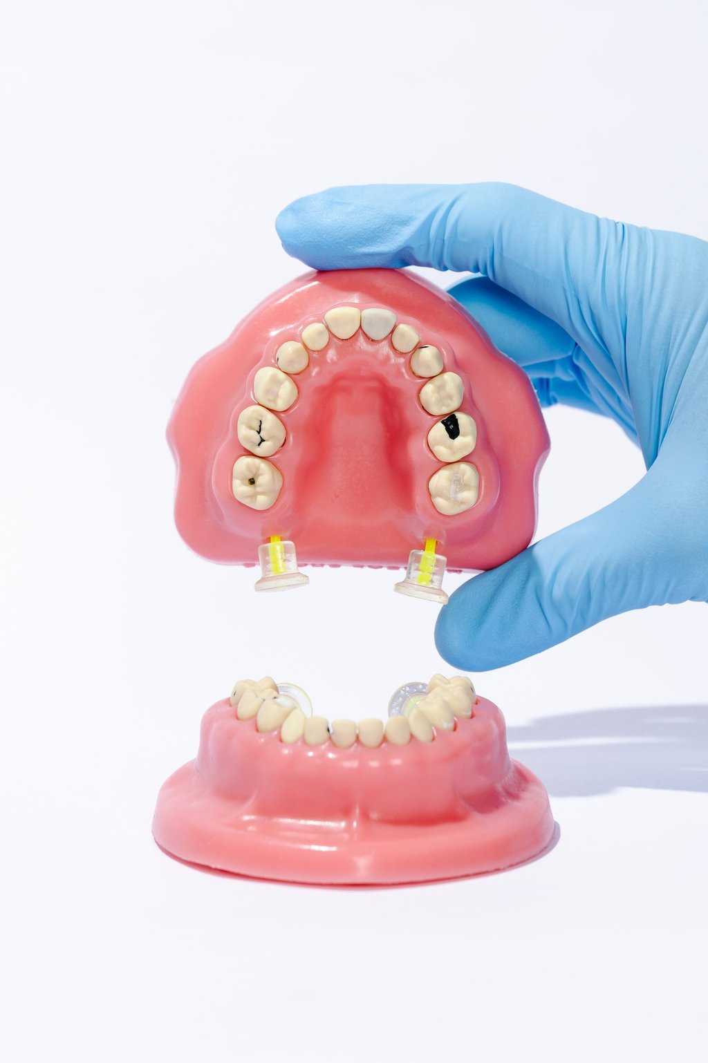 Modelo TOMI, con raíces divergentes que replican la anatomía pediátrica real