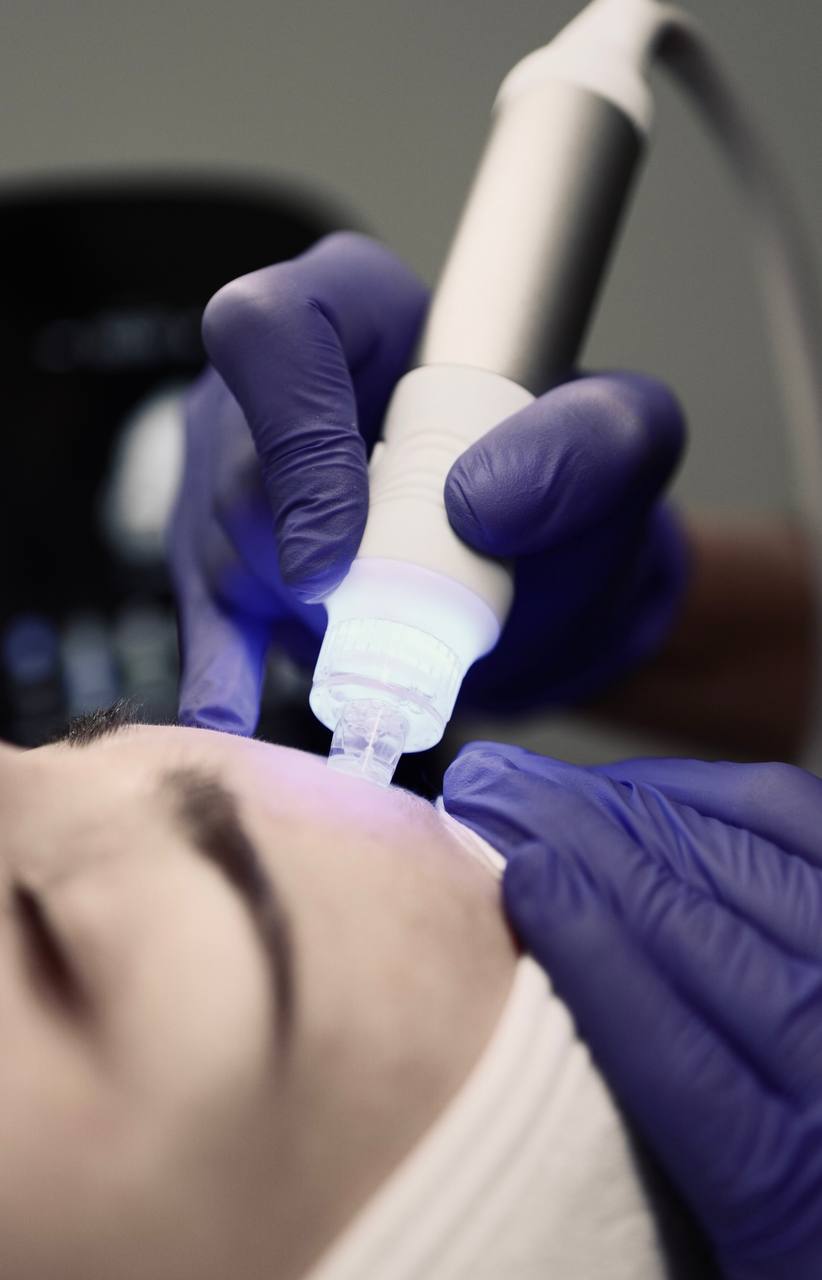 Zabieg oczyszczania wodorowego twarzy w OG Cosmetology